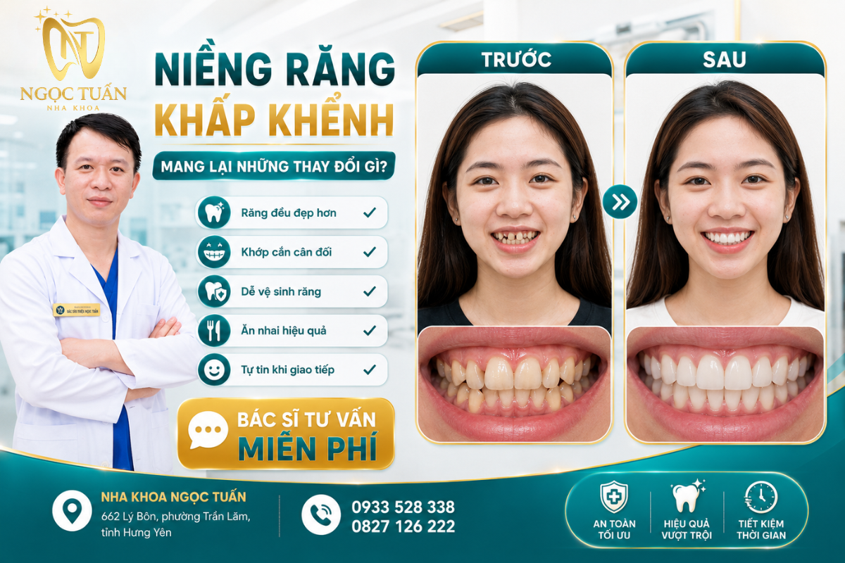 Lợi ích của niềng răng khấp khểnh tại Nha khoa Ngọc Tuấn
