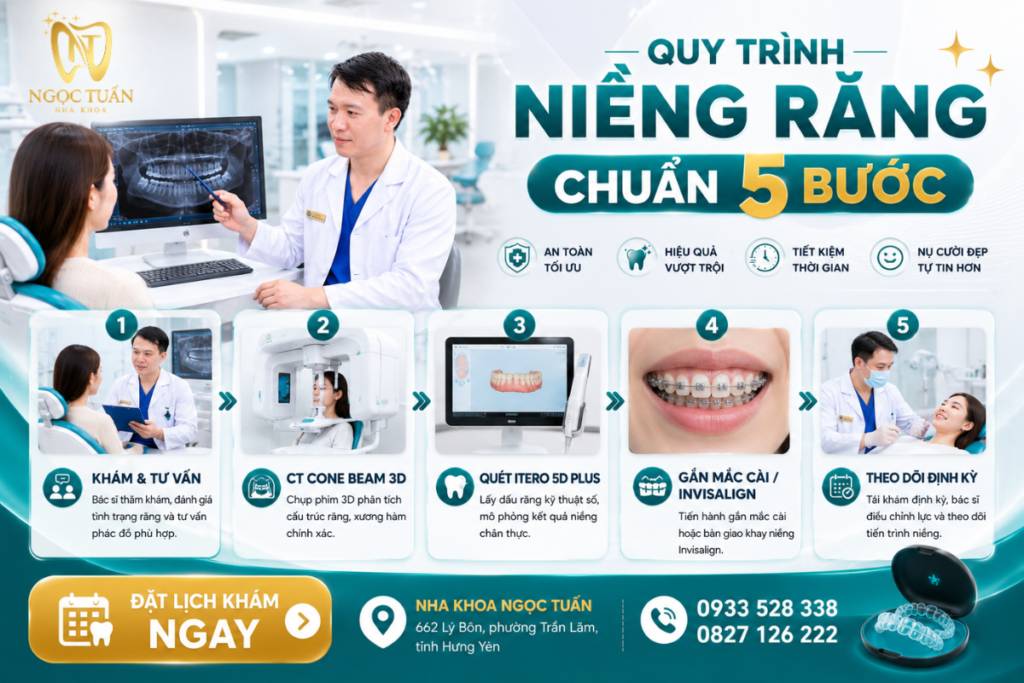 Quy trình niềng răng khấp khểnh tại Nha khoa Ngọc Tuấn