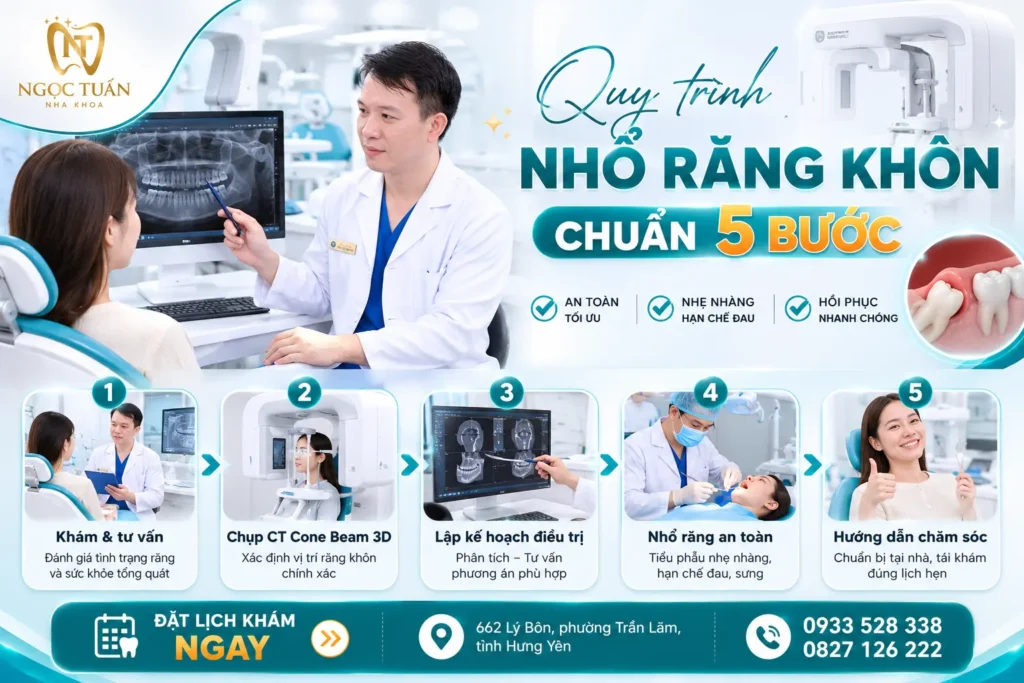 Quy trình nhổ răng khôn an toàn gồm khám, chụp CT Cone Beam 3D, lập kế hoạch điều trị, nhổ răng và hướng dẫn chăm sóc sau điều trị.