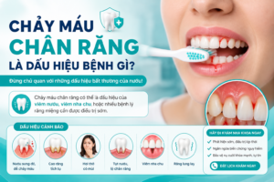 Quy trình lấy cao răng bằng máy siêu âm giúp làm sạch mảng bám và cao răng trên bề mặt răng