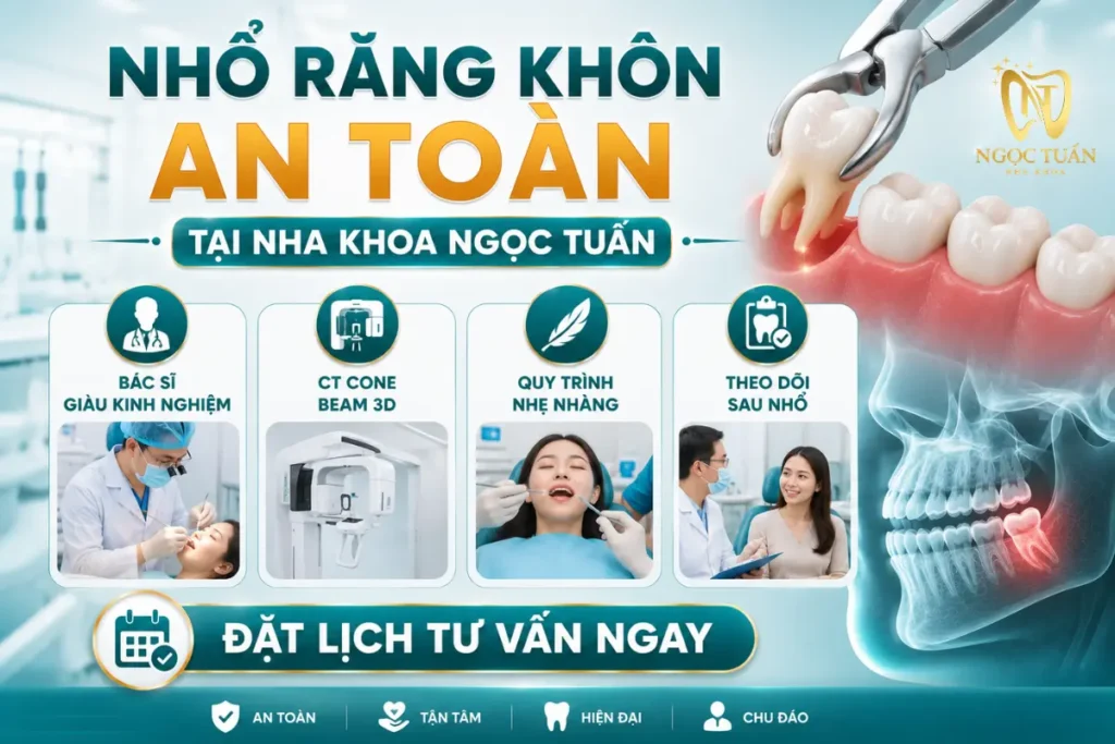 Nhổ răng khôn an toàn tại Nha khoa Ngọc Tuấn với bác sĩ giàu kinh nghiệm, chụp CT Cone Beam 3D, quy trình vô trùng và theo dõi sau điều trị.