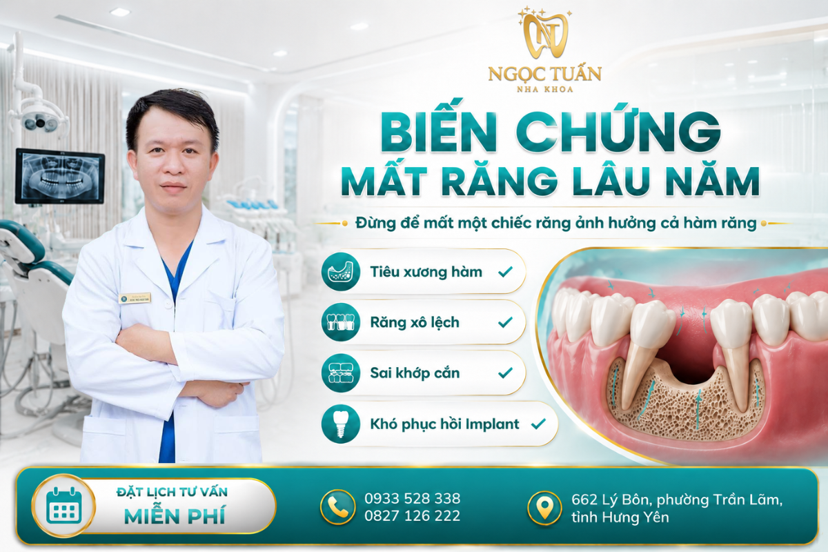 Banner giới thiệu các biến chứng mất răng lâu năm như tiêu xương hàm, răng xô lệch, sai khớp cắn và khó phục hồi Implant tại Nha khoa Ngọc Tuấn.