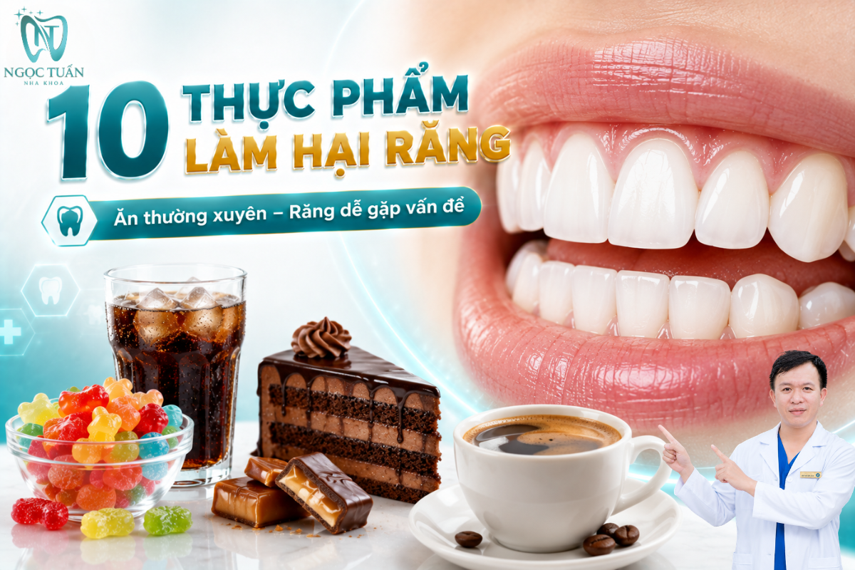 10 thực phẩm làm hại răng thường gặp gồm đồ ngọt, nước ngọt, thực phẩm có tính axit, đồ ăn quá cứng và đồ uống dễ gây nhiễm màu.