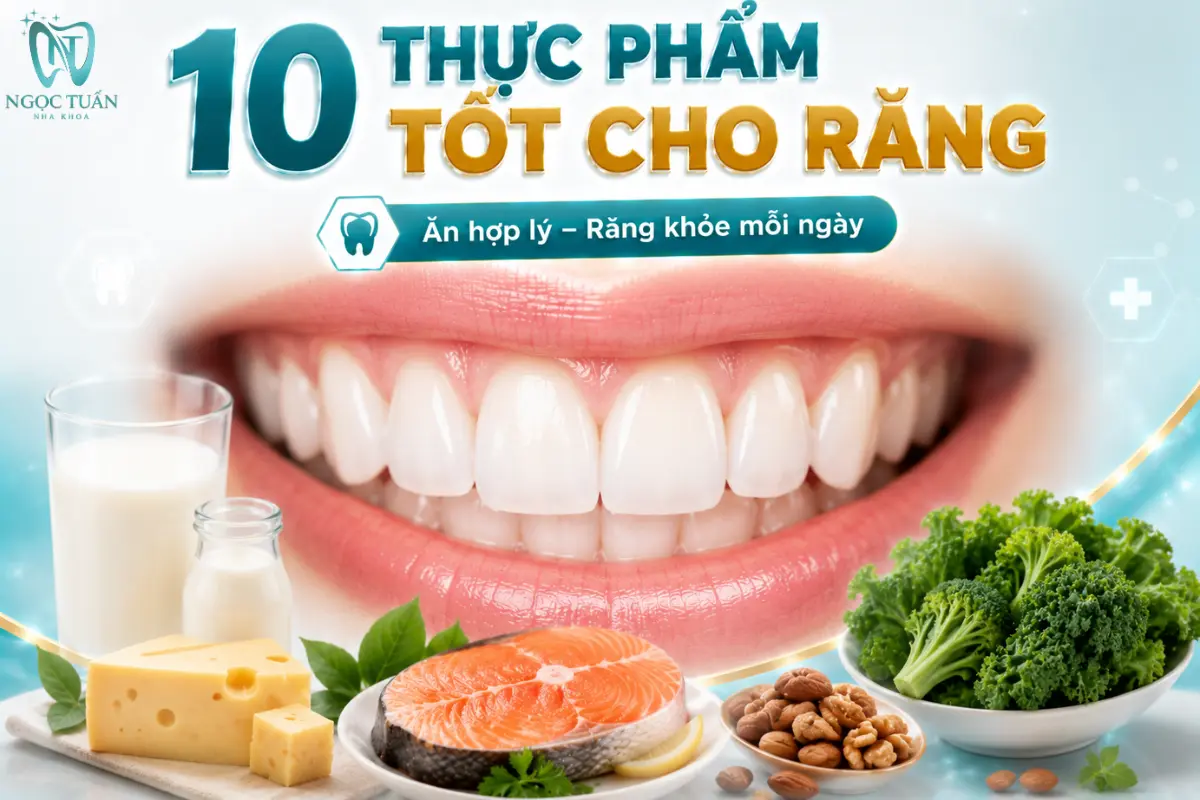 10 thực phẩm tốt cho răng cung cấp nhiều dưỡng chất quan trọng và góp phần xây dựng chế độ ăn thân thiện với sức khỏe răng miệng.