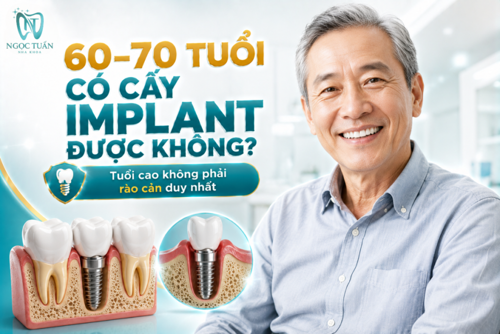 Người 60–70 tuổi vẫn có thể được cân nhắc cấy Implant nếu sức khỏe toàn thân, xương hàm và tình trạng răng miệng phù hợp.