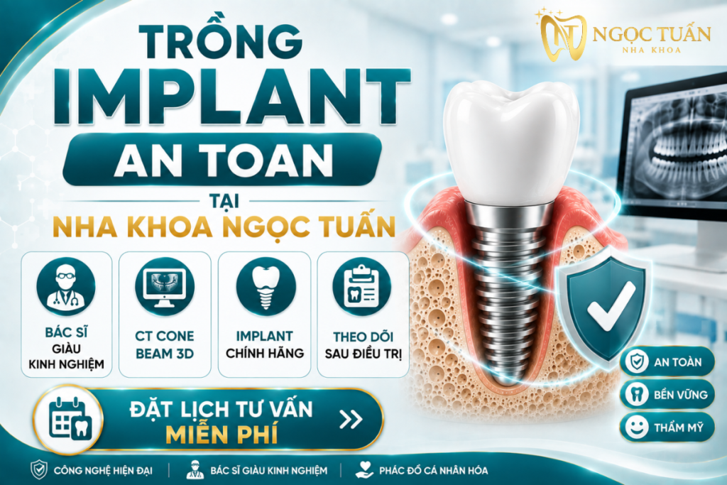 Những lưu ý giúp người mắc bệnh tiểu đường tăng khả năng tích hợp Implant và kéo dài tuổi thọ phục hình.