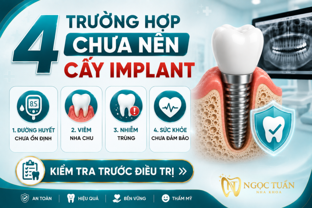 Những trường hợp người mắc bệnh tiểu đường cần trì hoãn cấy Implant để đảm bảo an toàn và tăng tỷ lệ thành công.