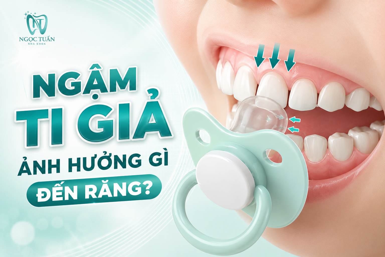 Ngậm ti giả ảnh hưởng gì? Thói quen kéo dài có thể liên quan đến răng cửa chìa, khớp cắn hở và những thay đổi về sự phát triển răng – hàm của trẻ.