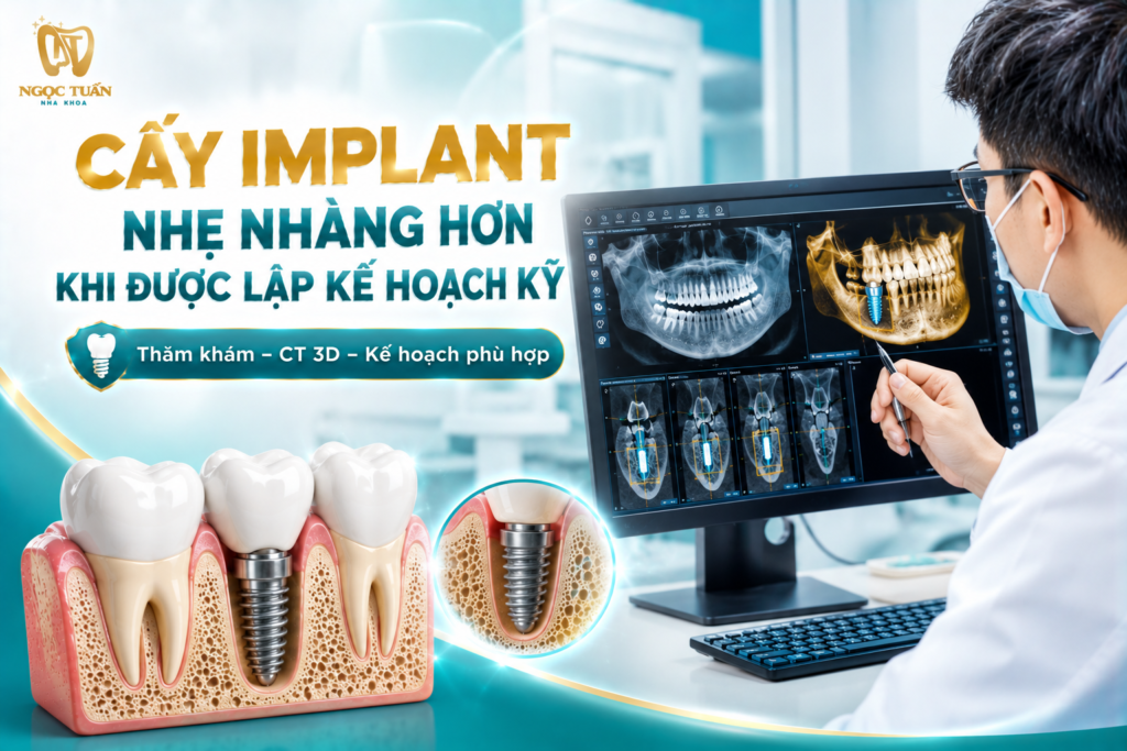 Thăm khám và đánh giá CT Cone Beam 3D khi có chỉ định hỗ trợ bác sĩ lập kế hoạch cấy Implant phù hợp với tình trạng xương hàm.