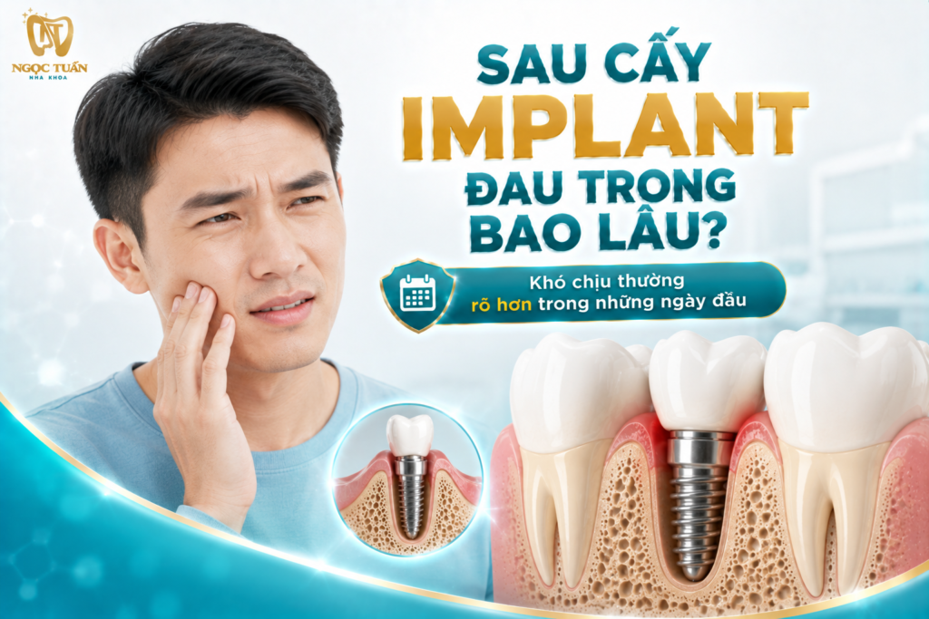 Đau, sưng và căng tức có thể xuất hiện trong những ngày đầu sau cấy Implant và thường cần có xu hướng giảm dần khi mô hồi phục.