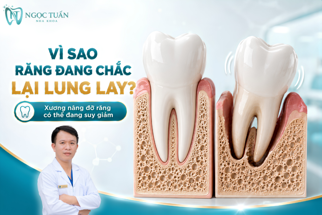 Khi mô nha chu và xương quanh chân răng bị phá hủy, khả năng nâng đỡ răng giảm và răng có thể bắt đầu lung lay.