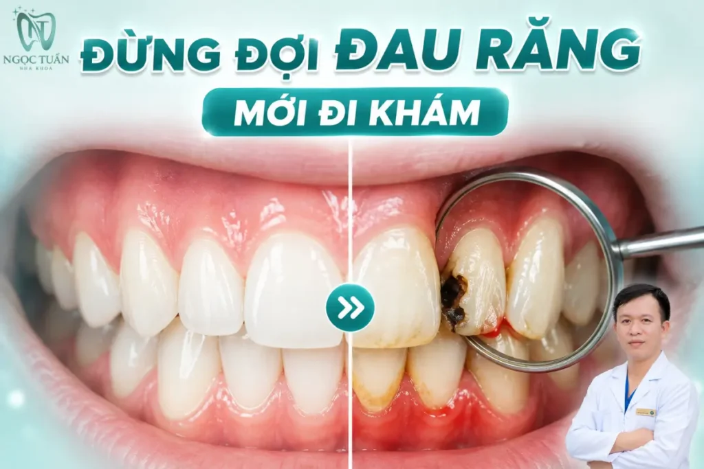 Nhiều bệnh lý răng miệng có thể tiến triển trước khi xuất hiện đau, vì vậy kiểm tra răng định kỳ giúp phát hiện bất thường sớm.