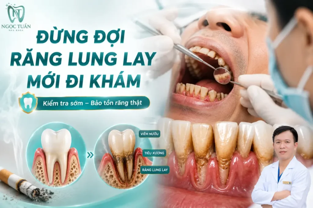 Người hút thuốc nên kiểm tra sức khỏe răng miệng định kỳ để phát hiện sớm bệnh nha chu và những tổn thương có nguy cơ dẫn đến mất răng.