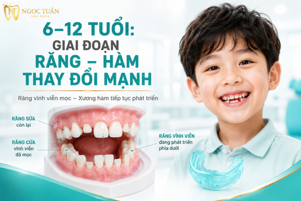 Giai đoạn 6–12 tuổi thường là thời kỳ răng hỗn hợp, khi răng vĩnh viễn tiếp tục mọc và xương hàm của trẻ vẫn phát triển.