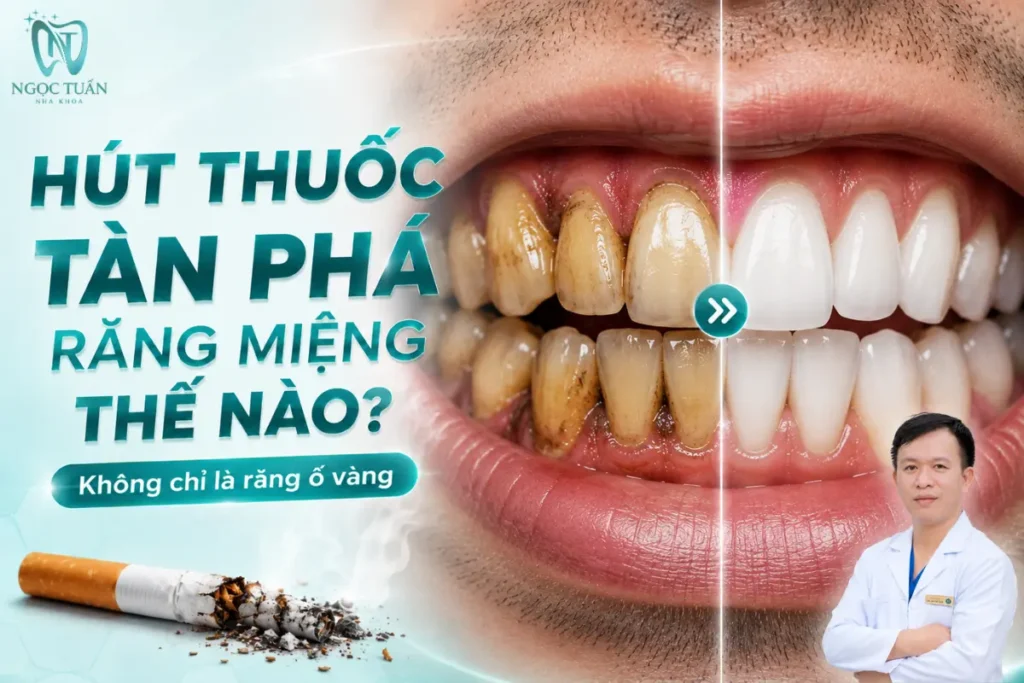Hút thuốc ảnh hưởng răng miệng từ màu sắc răng đến sức khỏe nướu, nha chu và khả năng duy trì răng thật.
