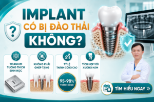 Implant có bị đào thải không? Trụ Implant Titanium có khả năng tương thích sinh học cao và rất hiếm khi bị đào thải theo cơ chế miễn dịch.