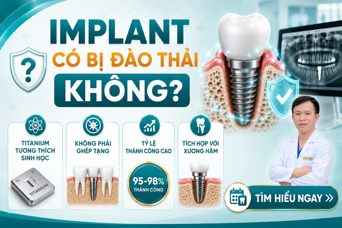 Implant có bị đào thải không? Trụ Implant Titanium có khả năng tương thích sinh học cao và rất hiếm khi bị đào thải theo cơ chế miễn dịch.