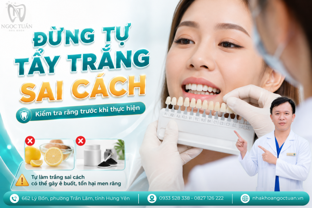 Kiểm tra sức khỏe răng và nướu trước khi tẩy trắng giúp xác định phương pháp phù hợp và hạn chế nguy cơ ê buốt, kích ứng.