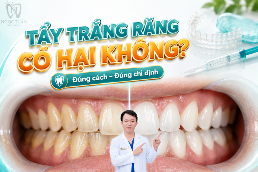 Tẩy trắng răng có hại không? Khi thực hiện đúng chỉ định và sử dụng sản phẩm phù hợp, tẩy trắng không đồng nghĩa với việc làm yếu răng.
