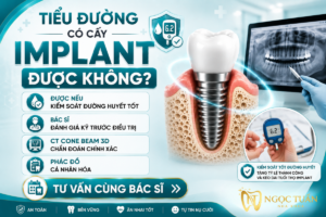 Người mắc bệnh tiểu đường vẫn có thể cấy ghép Implant nếu kiểm soát tốt đường huyết và được bác sĩ đánh giá đầy đủ trước điều trị.