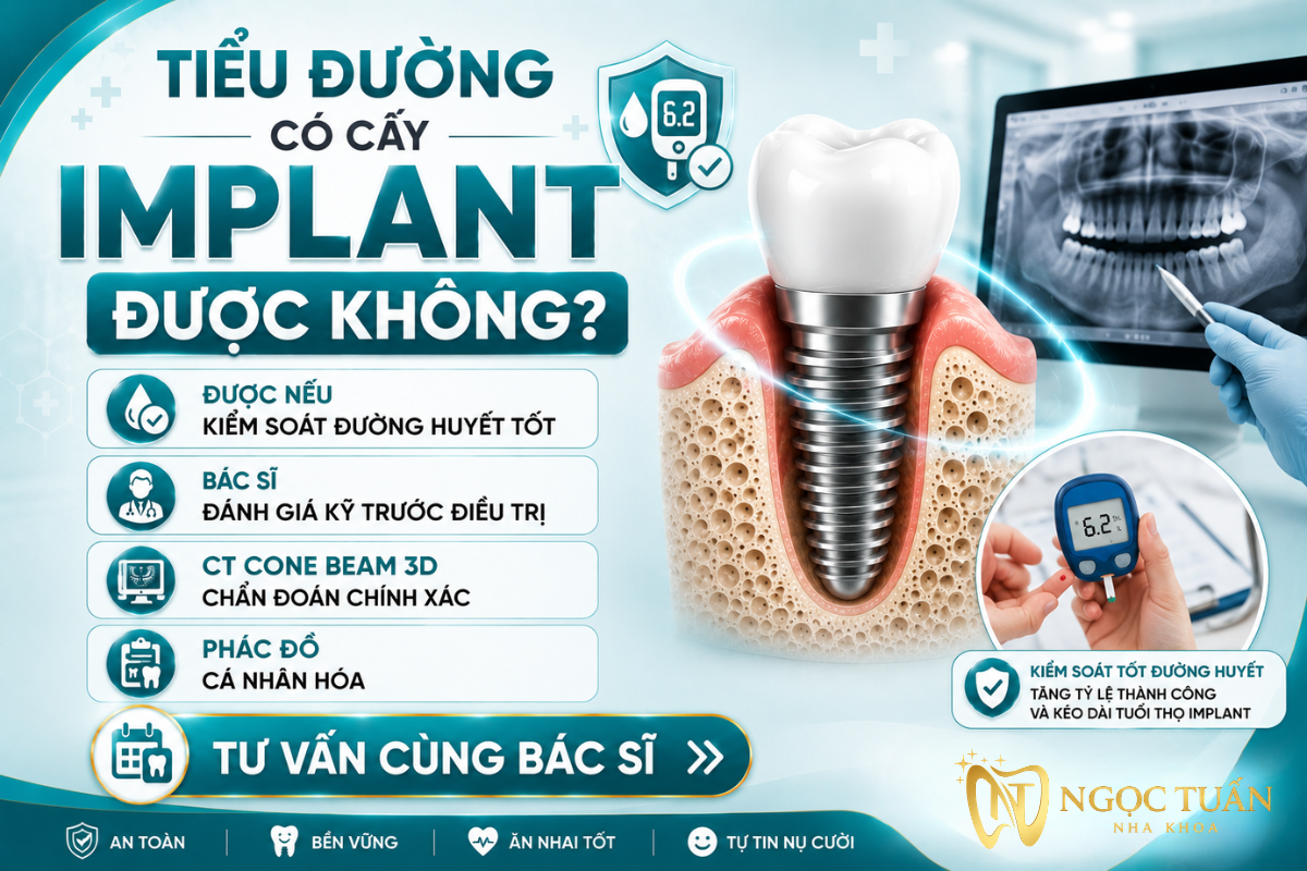 Người mắc bệnh tiểu đường vẫn có thể cấy ghép Implant nếu kiểm soát tốt đường huyết và được bác sĩ đánh giá đầy đủ trước điều trị.