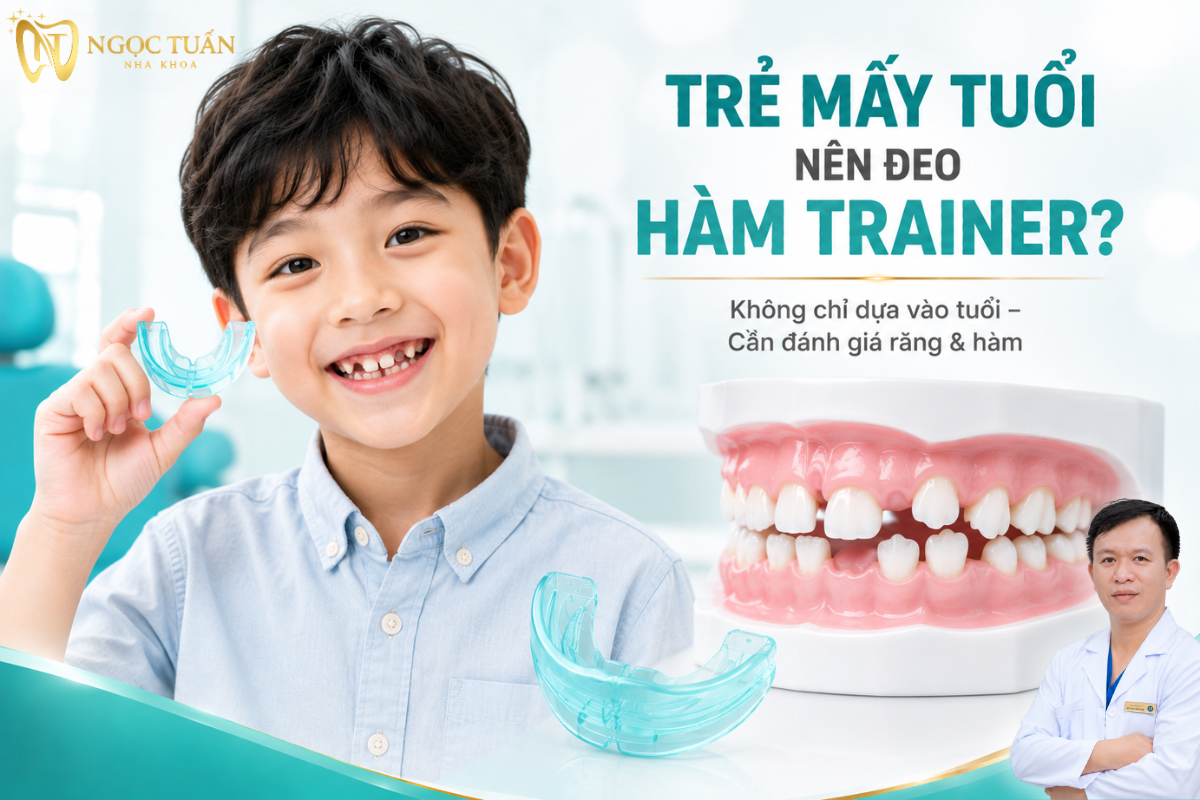 Độ tuổi sử dụng hàm Trainer cần dựa trên giai đoạn mọc răng, khớp cắn và sự phát triển răng hàm của từng trẻ.