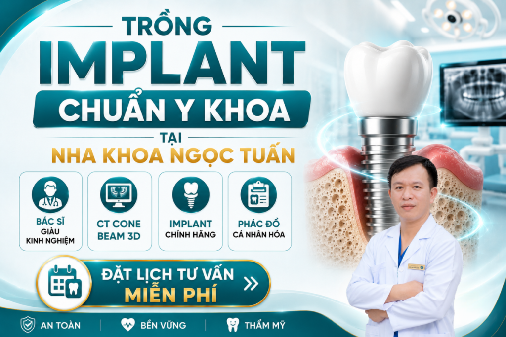 Trồng răng Implant tại Nha khoa Ngọc Tuấn với quy trình chuẩn y khoa, công nghệ hiện đại và đội ngũ bác sĩ giàu kinh nghiệm.