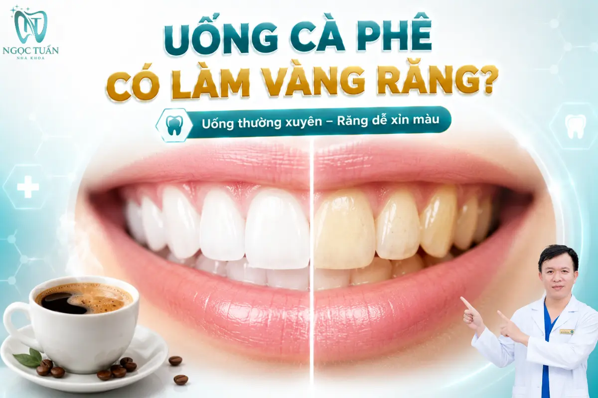 Uống cà phê thường xuyên có thể khiến sắc tố tích tụ trên bề mặt và làm răng dần trở nên xỉn màu.