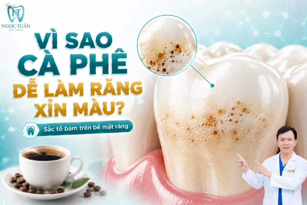Các hợp chất tạo màu trong cà phê có thể tích tụ trên bề mặt răng và góp phần khiến răng xỉn màu theo thời gian.