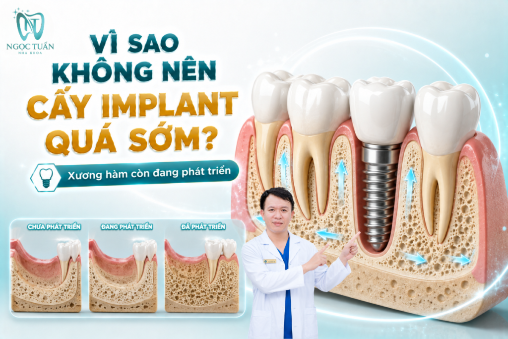 Cấy Implant khi xương hàm chưa hoàn tất phát triển có thể dẫn đến sai lệch tương quan giữa Implant với các răng và mô xung quanh về sau.