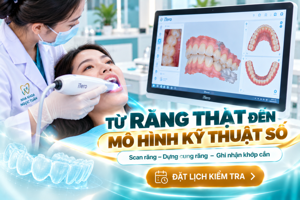 Scan răng bằng iTero giúp chuyển hình thái cung răng thật thành mô hình kỹ thuật số phục vụ đánh giá nha khoa.