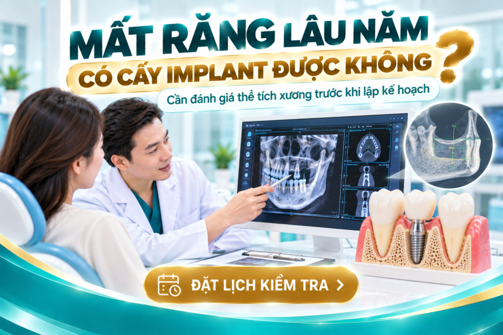 Mất răng lâu năm vẫn có thể được đánh giá khả năng cấy Implant dựa trên tình trạng xương thực tế.