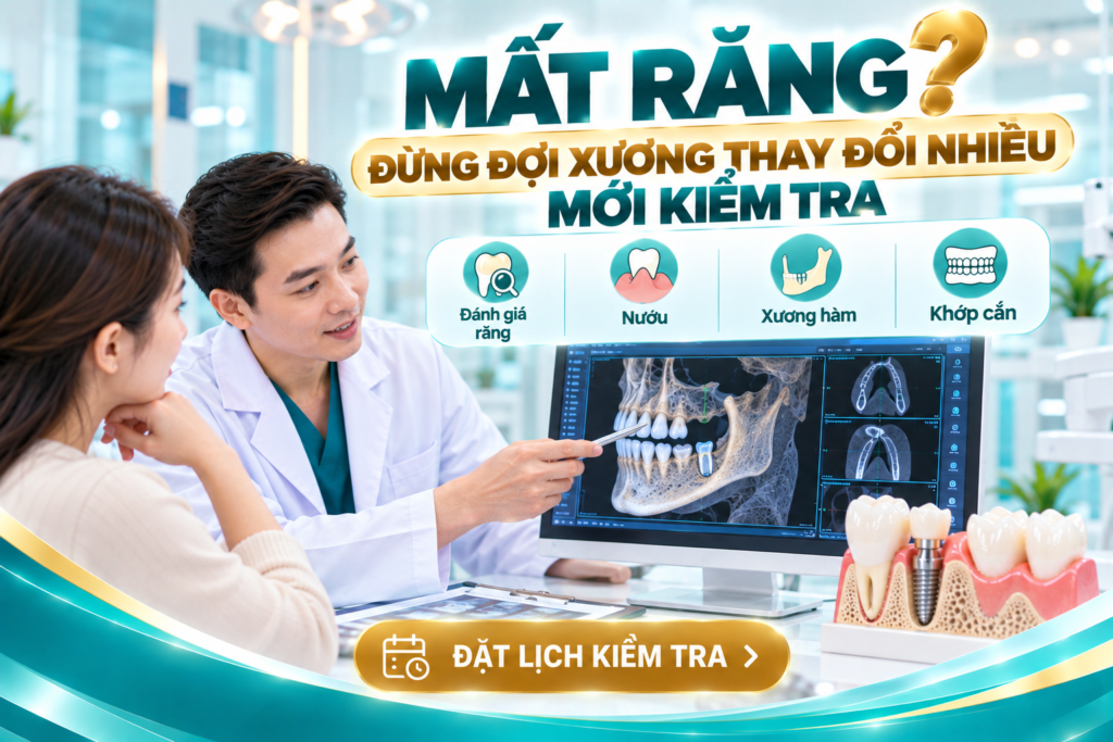 Khuyến nghị đánh giá vùng xương hàm sau mất răng để lựa chọn kế hoạch phục hồi phù hợp.
