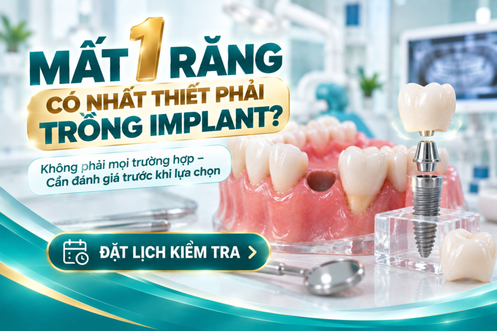 Giải thích việc mất một răng không đồng nghĩa tất cả trường hợp đều bắt buộc phải cấy Implant.