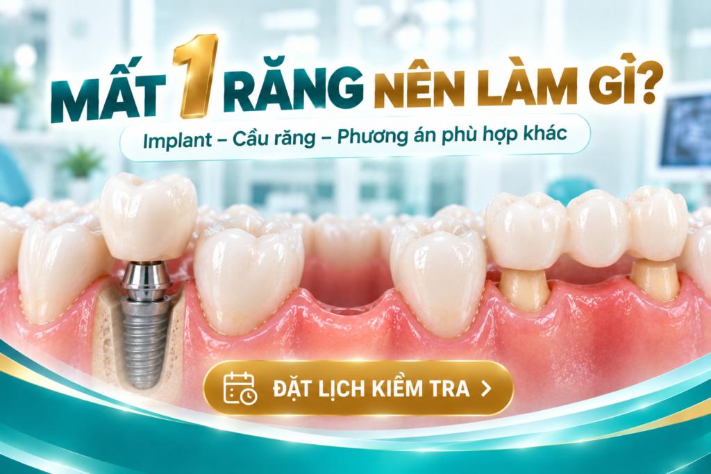 Các phương án có thể được cân nhắc khi mất một răng.