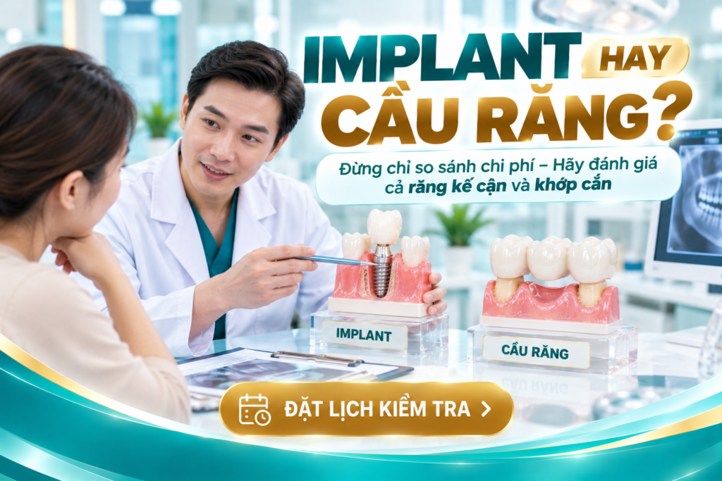 So sánh nguyên lý Implant và cầu răng khi phục hồi một răng mất.
