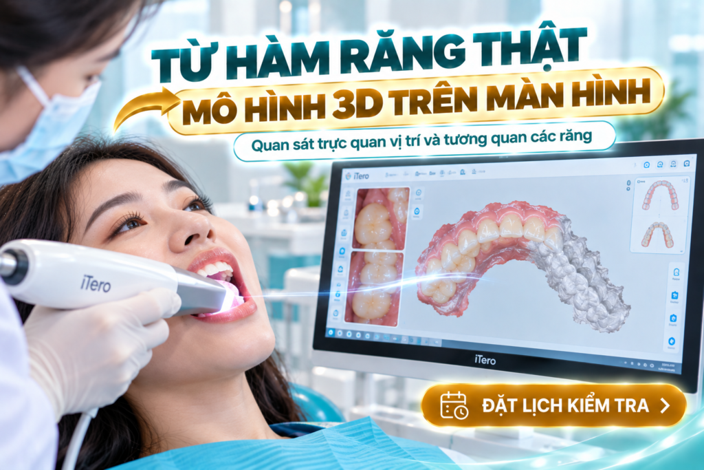 Quét răng 3D chỉnh nha giúp chuyển hình dạng cung răng thành mô hình kỹ thuật số để hỗ trợ phân tích.