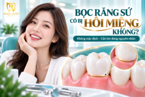 Giải thích tình trạng hôi miệng sau khi bọc răng sứ và những nguyên nhân cần kiểm tra.