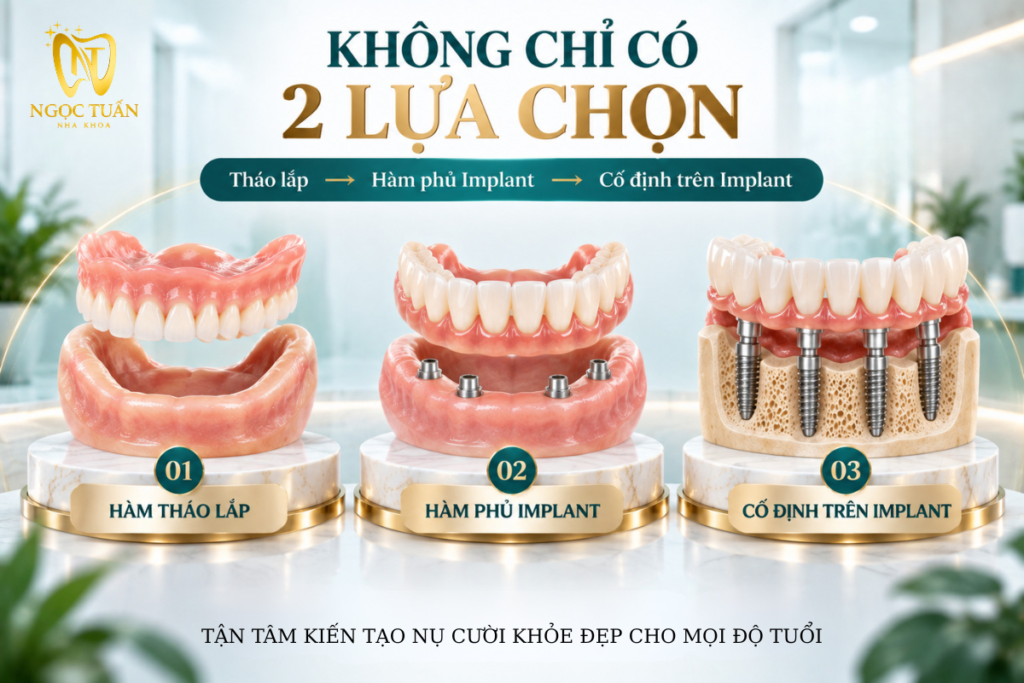 Người lớn tuổi mất toàn hàm có thể được đánh giá nhiều phương án từ hàm tháo lắp, hàm phủ Implant đến phục hình cố định trên Implant.