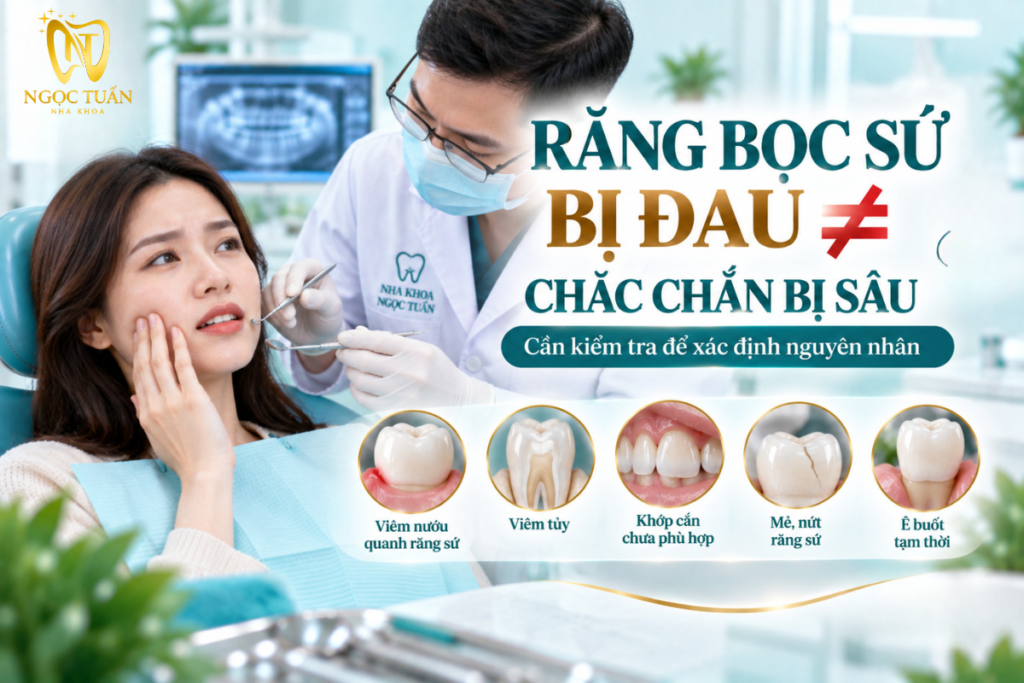 Hướng dẫn chăm sóc răng sứ và răng thật nhằm hạn chế mảng bám và nguy cơ sâu răng.