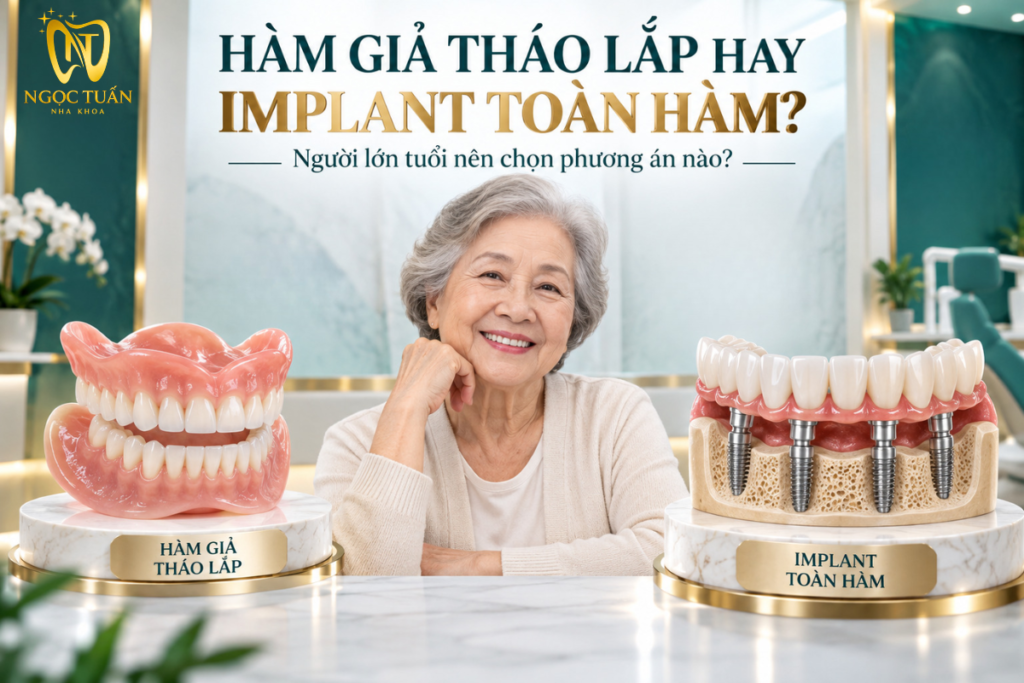 So sánh hàm giả tháo lắp và Implant toàn hàm để lựa chọn phương án phục hình phù hợp cho người lớn tuổi mất nhiều răng.