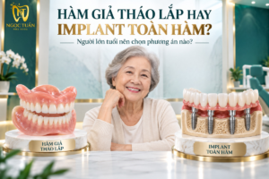 So sánh hàm giả tháo lắp và Implant toàn hàm để lựa chọn phương án phục hình phù hợp cho người lớn tuổi mất nhiều răng.