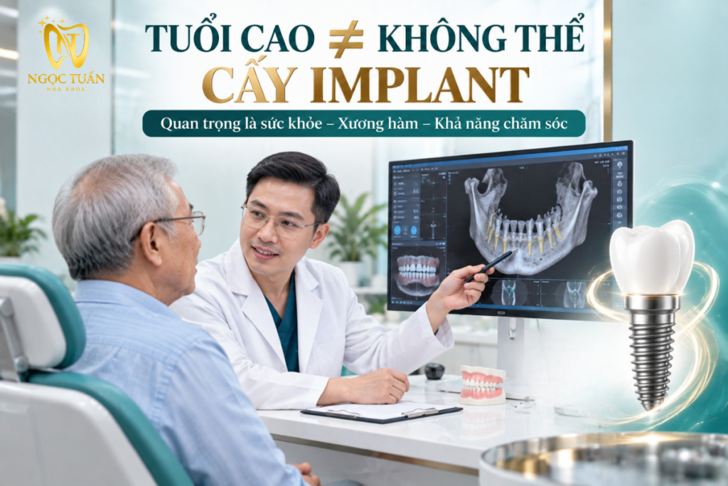 Tuổi cao không phải yếu tố duy nhất quyết định khả năng cấy Implant; cần đánh giá sức khỏe, xương hàm và điều kiện chăm sóc.
