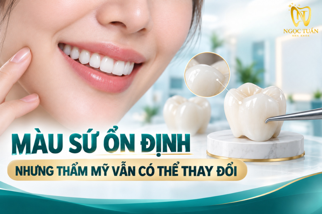 Giải thích răng sứ có bị đổi màu theo thời gian và những yếu tố ảnh hưởng đến thẩm mỹ phục hình.