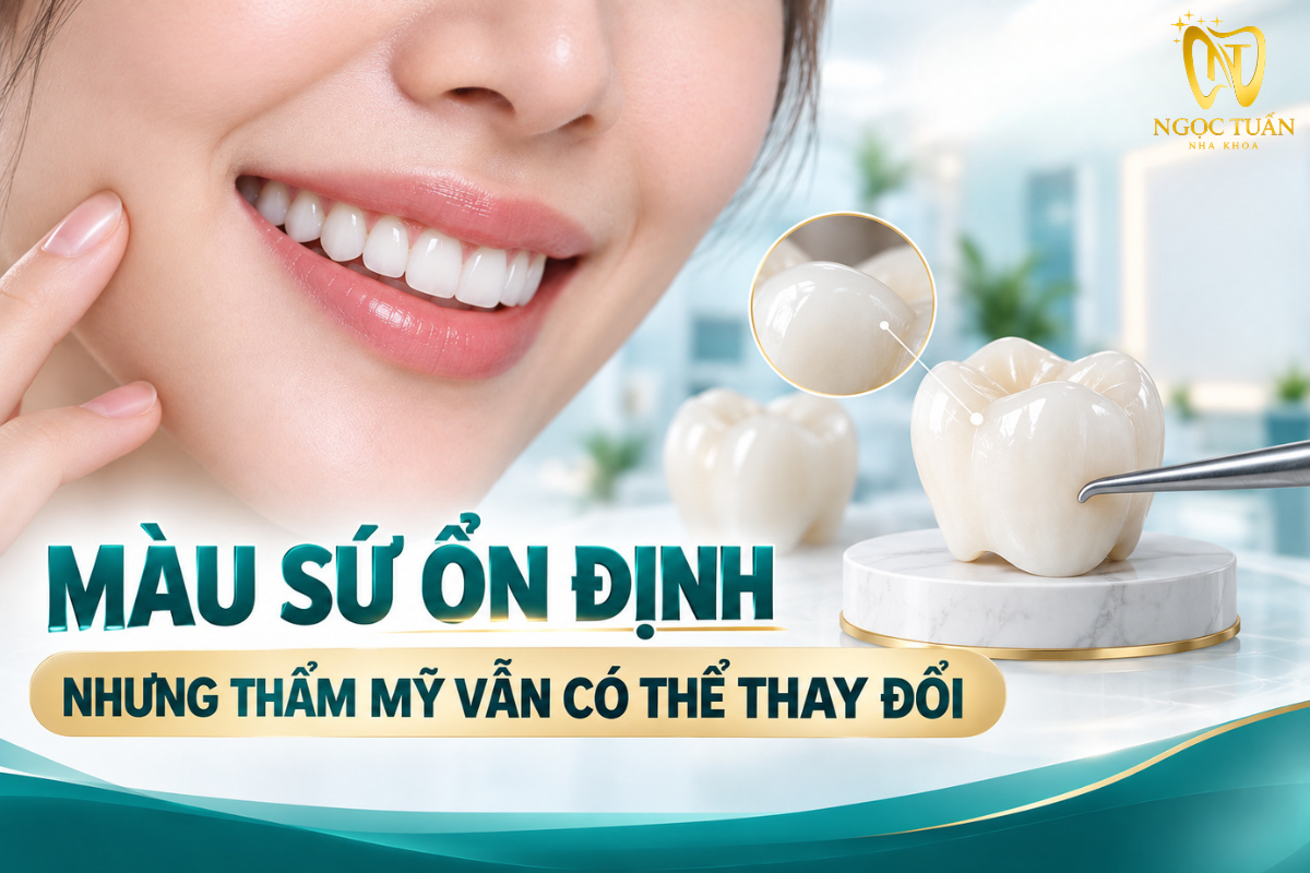 Giải thích răng sứ có bị đổi màu theo thời gian và những yếu tố ảnh hưởng đến thẩm mỹ phục hình.