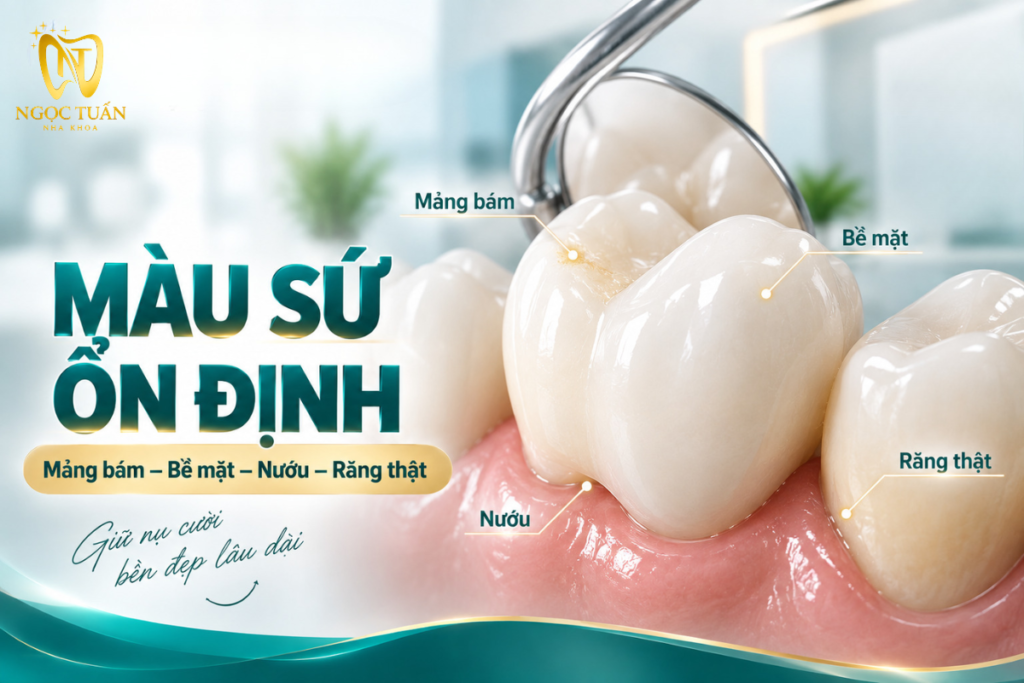 Các nguyên nhân có thể khiến răng sứ trông vàng hoặc xỉn màu sau thời gian sử dụng.