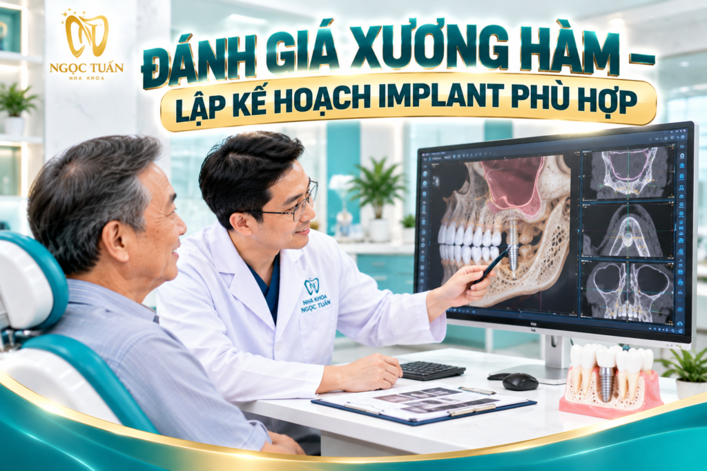 Lập kế hoạch Implant cá nhân hóa giúp lựa chọn kỹ thuật tăng cường xương và phương án phục hình phù hợp với tình trạng xương hàm.