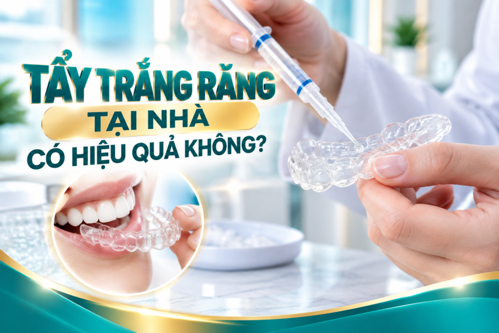 Kiểm tra tình trạng răng và mô nướu trước tẩy trắng giúp lựa chọn phương pháp phù hợp và hạn chế nguy cơ ê buốt, kích ứng.
