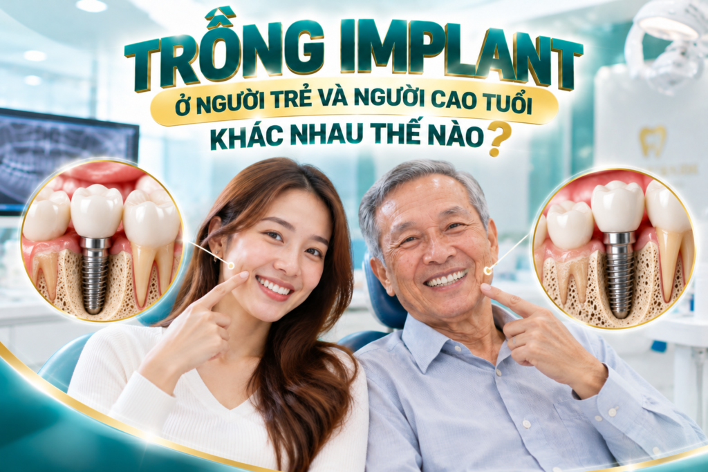 Trồng Implant ở người trẻ và người cao tuổi khác nhau về điều kiện xương hàm, sức khỏe và kế hoạch điều trị.
