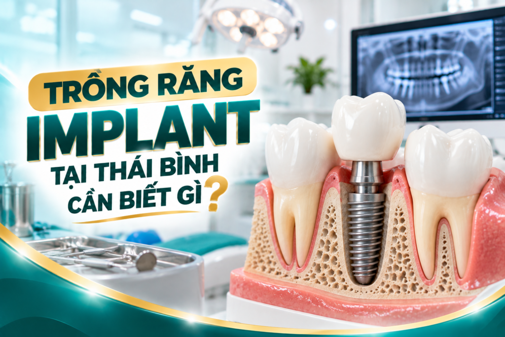 Trồng răng Implant tại Thái Bình cần được đánh giá kỹ về xương hàm, sức khỏe và kế hoạch phục hình trước khi thực hiện.